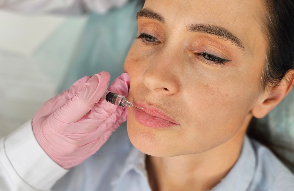 Dermal filler aesthetic treatment